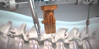 Top best robotic spine surgery hospitals in India