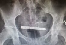 Small wearable adult toys can cause health hazards to women