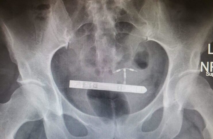 Small wearable adult toys can cause health hazards to women