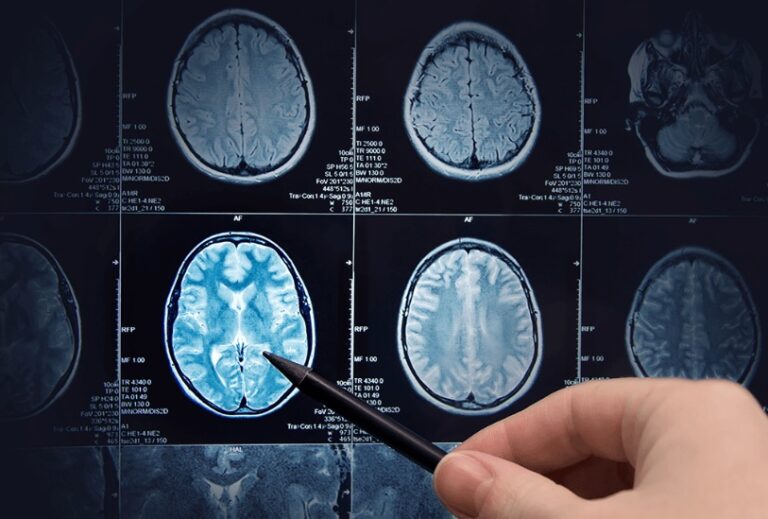 deep-learning-in-medical-image-processing-scope-and-challenges