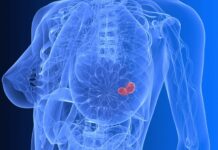 Artificial intelligence in cancer imaging – Current trends cancer imaging