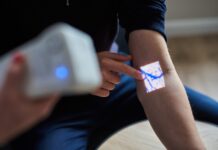 Vein scanner for venipuncture: Is it a game-changer? Vein Scanner