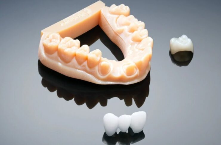 3D printing in dentistry – Applications dentistry